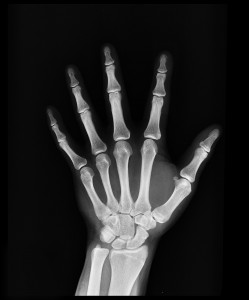 x-ray-1704855_1280